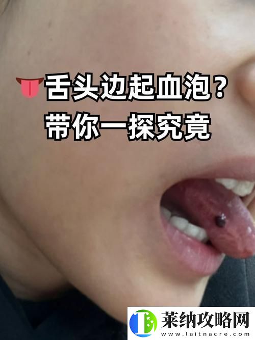 探秘